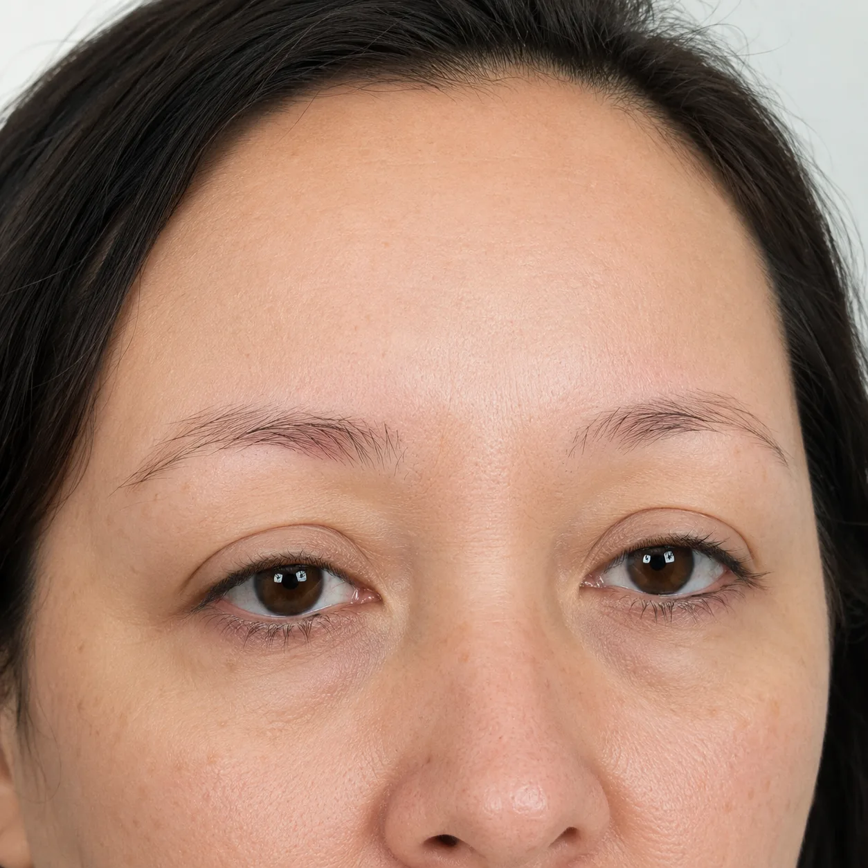 Thinning Eyebrows Look Sparse